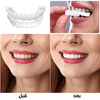 إبتسامة هوليود سمايل