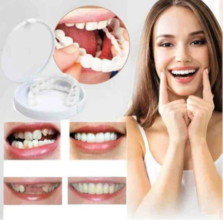 إبتسامة هوليود سمايل