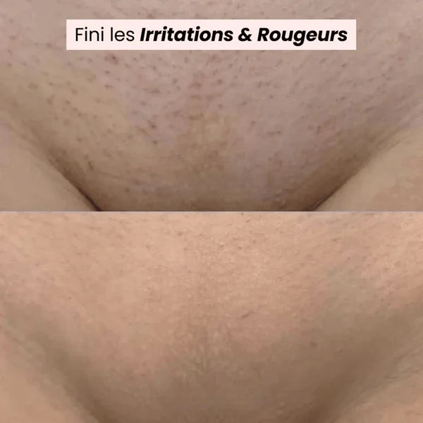 Tondeuse bikini et corps 2 en 1