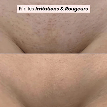 Tondeuse bikini et corps 2 en 1