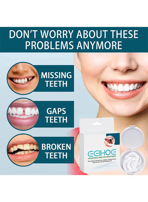 إبتسامة هوليود سمايل